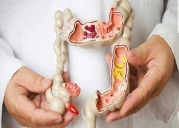 Tổng quan về bệnh ung thư đại trực tràng