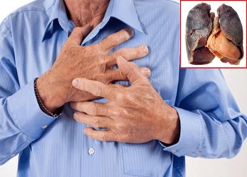 Tổng quan và nguyên nhân mắc ung thư phổi